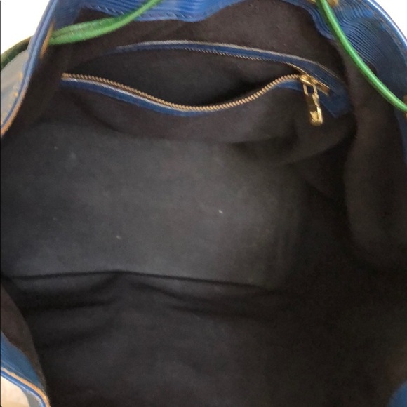 Large LV Epi Noe - Picture 6 of 9